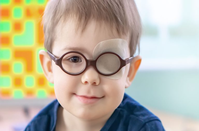 تشخیص زودهنگام، کلید درمان تنبلی چشم: راهکارهای طلایی برای والدین