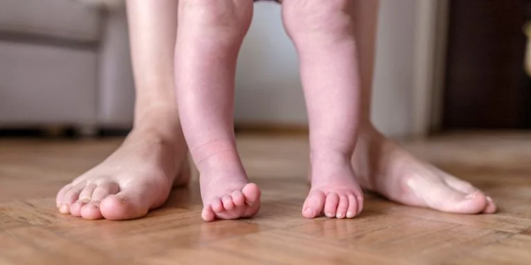 شایع ترین اختلالات ساق پا در نوزادان: علائم، تشخیص و درمان